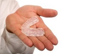 picture of a mouth guard resting on a man's palm