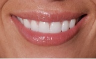 close up picture of a woman's smile